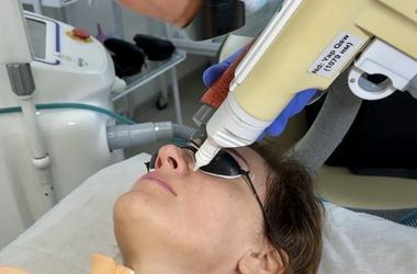 Лазерное удаление сосудов