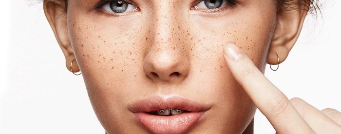 ДОЛОЙ ПИГМЕНТНЫЕ ПЯТНА