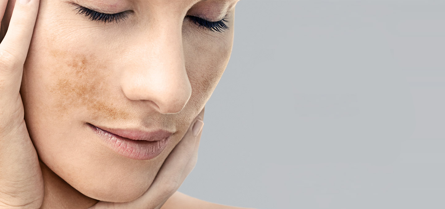 Пигментация кожи лица как бороться