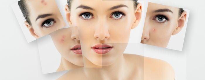 ЛИЦО В ДЫРОЧКУ, ТЕЛО В ПОЛОСОЧКУ