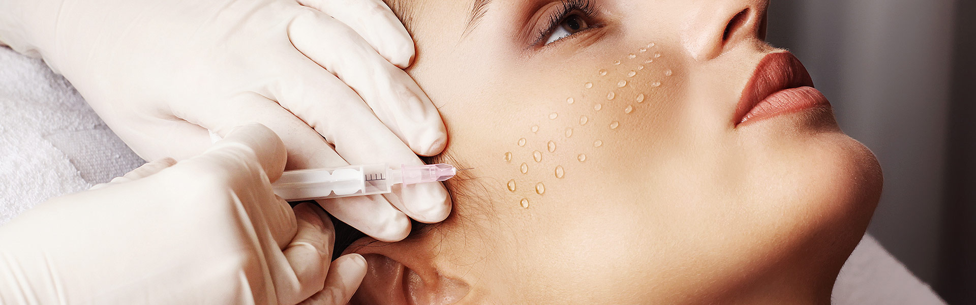 Мезотерапия в линлайн