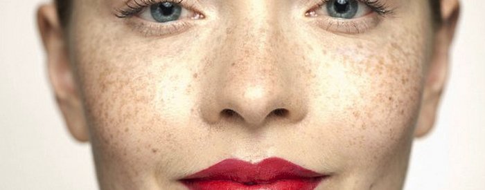 ВЫВОДИМ ПЯТНА НА ЛИЦЕ И ТЕЛЕ