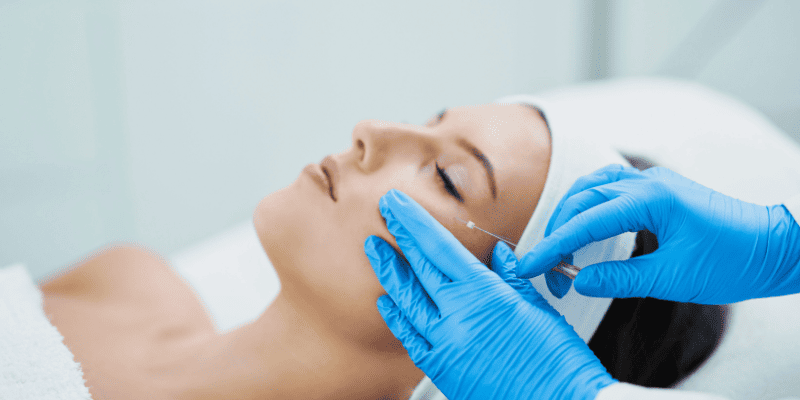 Нитевой лифтинг