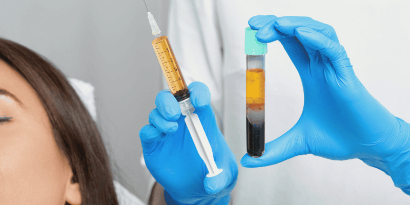 Плазмотерапия лица