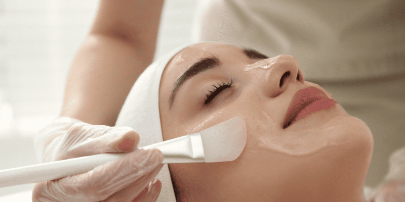 Химический пилинг кожи лица