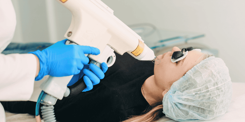 Глубокое фракционное неодимовое омоложение (Nd 1320 нм)