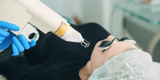 Лазерное омоложение SkinSMA в Минске