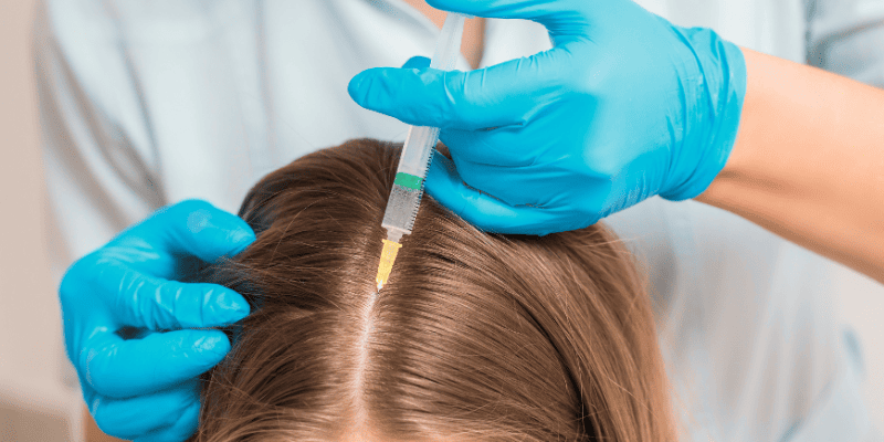 Мезотерапия для волос
